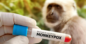 Угроза распространения оспы обезьян на Бали привела к ужесточению контроля в аэропорту